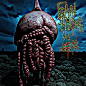 Colorectal Ridges Like A Vacuum Cleaner Hose