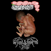 Encephalopathy In The Gi Tract / Anal Birth