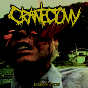 Incineration