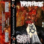 split with Hyperemesis