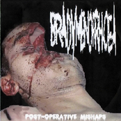 Post-Operative Mishaps