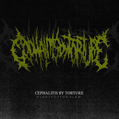 Cephalitis By Torture