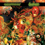 Goreossion / Hematemesis