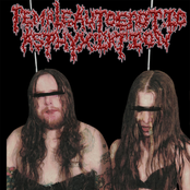 Sexual Asphyxia And Autoerotic Fatalities