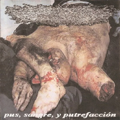 Pus, Sangre Y Putrefacción