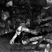 Putrefaction