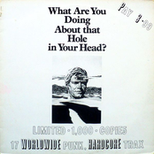 What Are You Doing About That Hole In Your Head?