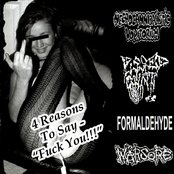 4 Reasons To Say - ''Fuck You!!!''