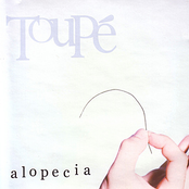 Alopecia