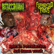 Rest in Putrefaction and Human Wreck