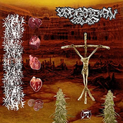 Cerebral Atrophy