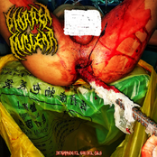 Destapando el Ojo del Culo