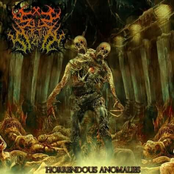 Horrendous Anomalies