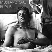 Mustard Gas Burns