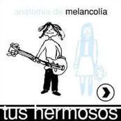 Anatomía de la melancolía