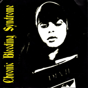 weekend nachos / chronic bleeding syndrome