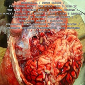 Hebephilia / Fetus Kalops / FxRxCxBxTxAxPxIxTxLxOxRxPx / Diarrhea Tsunami / AxMxPxHxFxIxHxSxAx / Carcinomas Of Unknown Primary Origin / Mutilated Infant / SxCxAxTx / Perforated Bowel Syndrome With Oozing Faeces / UxDxXxMxGxSx