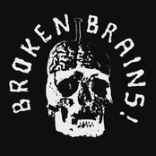 broken brains