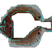 Lepidorhombus whiffiagonis (Demo-Album)