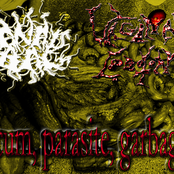 scum, parasite, garbage