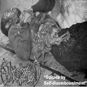 Suicide By Self-Disembowelment