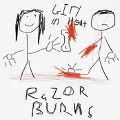 Razor Burns