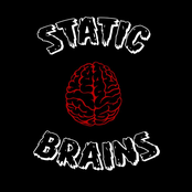 static brains