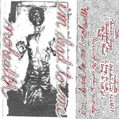 I'm Dead To Me / NOHEALTH