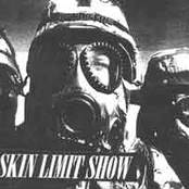 Skin Limit Show