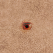 Diseased