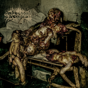 Compressed Cylinder of Brain Matter