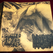 Liquified Organ Catheter / Hydrocephalus