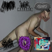 Lycoperdon Picholas Perlatum / Puta Malaria / Odio / SavvaxravvA / VxCxCxWxOxBxPx / NTAP