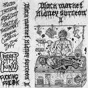 Black Market Kidney Surgeon II