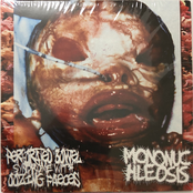 Perforated Bowel Syndrome With Oozing Faeces / Mononuchleosis