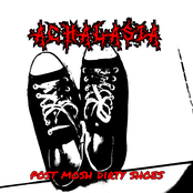 Post Mosh Dirty Shoes