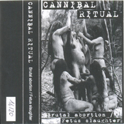 Brutal Abortion / Fetus Slaughter