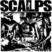 Scalps