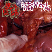 Blasted Pancreas/Borborygmus