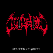 Skeletal Laughter