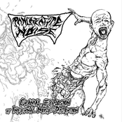 Cranial Explosion by Infernal Noise Distortion