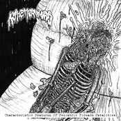 Characteristic Features Of Pediatric Firearm Fatalities