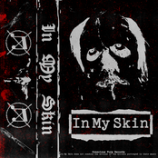 In My Skin