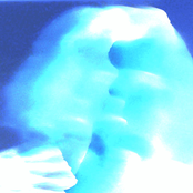 Look At Me, Another Circus Clown!