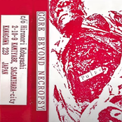 I Recommend You... Amputation