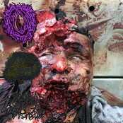 VxCxCxWxOxBxPx / Cirrhosis of the Liver / Jenkem from a Paraplegic