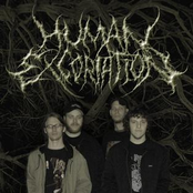 human excoriation