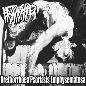 Urethorrhoea Psoriasis Emphysematosa