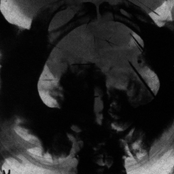 Integrity/Pale Creation Split