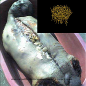 Collapsed Raped And Filled With Ebola Insects From A House Made Of Of Corrupt Living Things